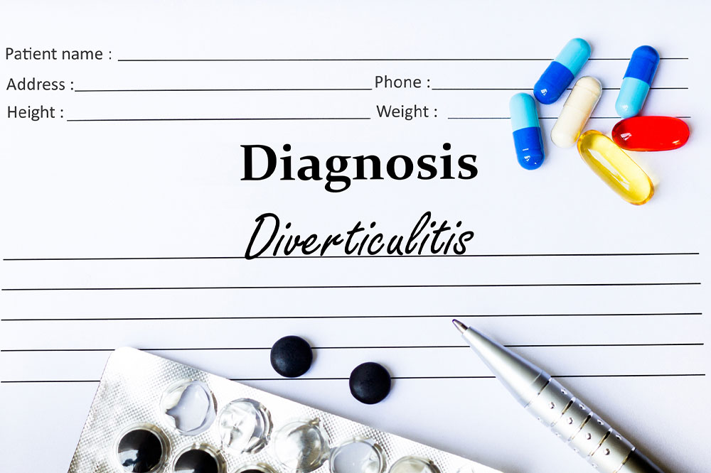 Diverticulitis – Causes, Symptoms, and How to Manage the Condition